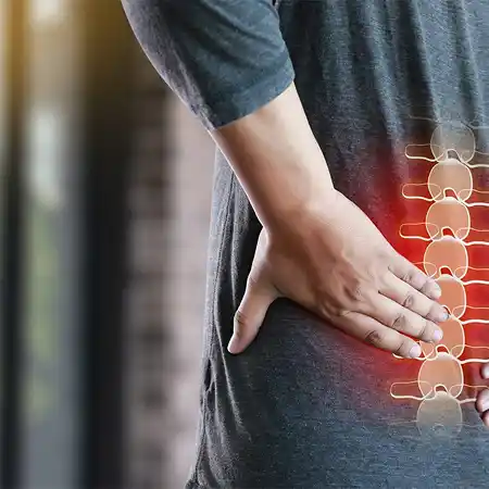 Herniated and bulging discs