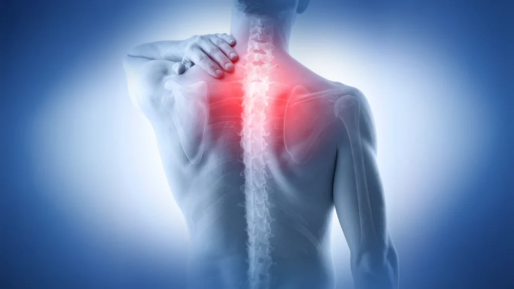 When Should You See a Chiropractor for Upper Back Pain